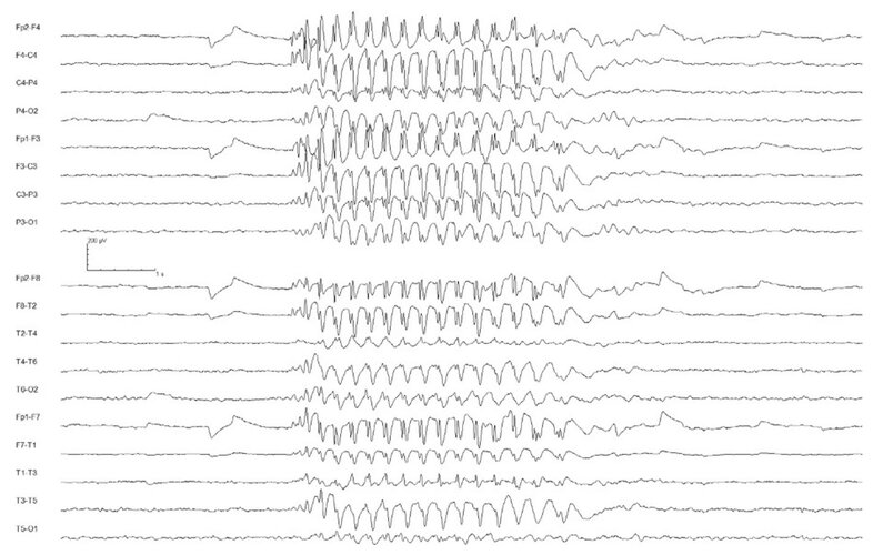 EEG_2.jpg